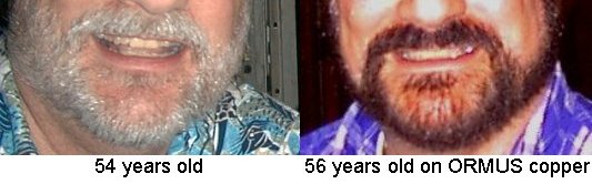 beard