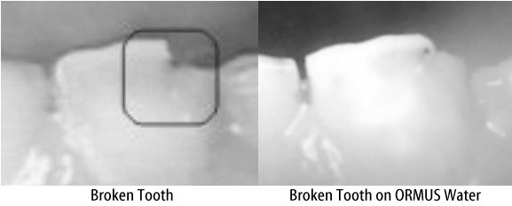 toothpic